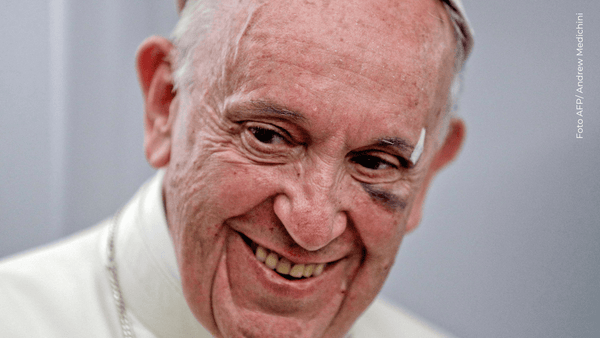 Así fue el día en que el Papa Francisco se golpeó en Cartagena en su papamóvil