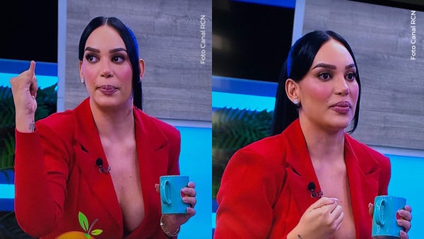 Andrea Valdiri sufrió accidente previo a ingresar a La casa de los famosos, ¿qué le pasó? Andrea Valdiri sufrió accidente previo a ingresar a La casa de los famosos, ¿qué le pasó?