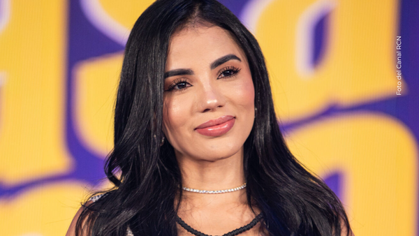 Karina García reveló el tratamiento rejuvenecedor que se hizo en la cara, ¿en qué consiste?