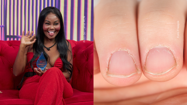 La Jesuu mostró sus uñas deterioradas y causó alboroto, ¿por qué no le crecen? La Jesuu mostró sus uñas deterioradas y causó alboroto, ¿por qué no le crecen?