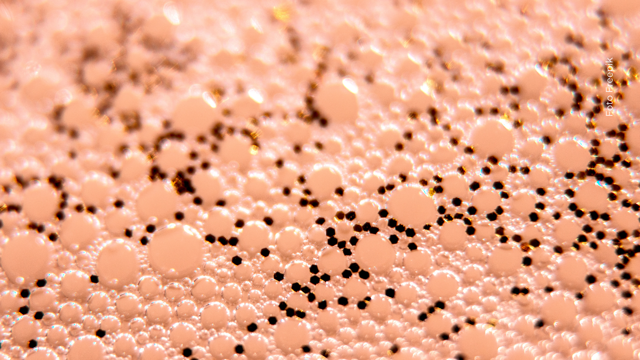 Los puntos negros afectan especialmente a personas con piel grasa o poros dilatados.