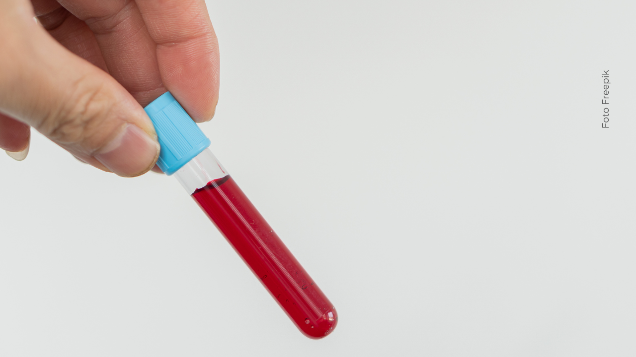 Prueba de sangre Prueba de sangre