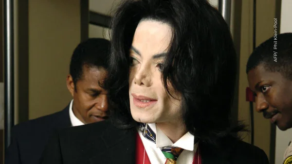 Vitíligo: la enfermedad que afectó la piel de Michael Jackson