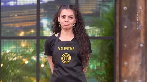 Valentina Taguado mostró sus quemaduras