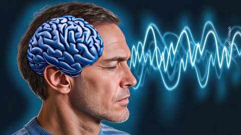 Cerebro