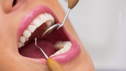 La queratina mostró resultados sorprendentes en la regeneración del esmalte dental.