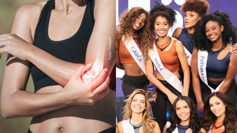Candidata de Miss Universe Colombia, el reality padece de lupus eritematoso sistémico