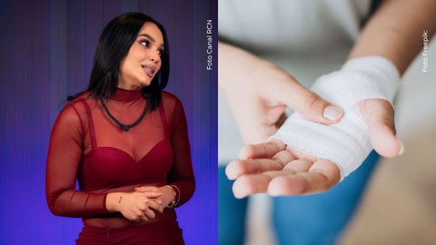Andrea Valdiri mostró lo que le pasó en la mano