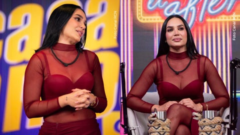 Andrea Valdiri mostró su reacción al verse la herida de la mano