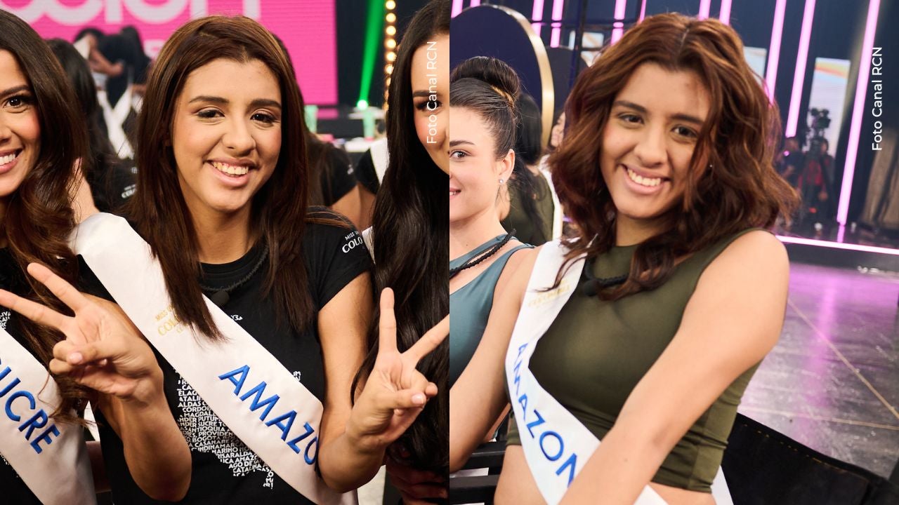 Rebeca Castillo, Miss Amazonas Rebeca Castillo, Miss Amazonas, se hizo retoque en el rostro