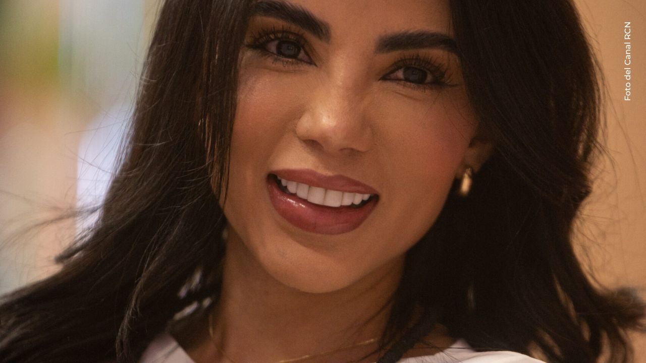 Karina García reveló cómo quedó después de someterse a un nuevo retoque facial