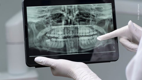 La Segura sorprendió al revelar inesperado accidente dental