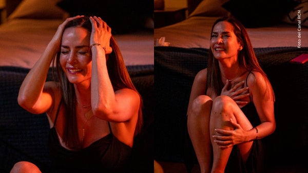 Carmen Villalobos preocupó al enseñar moretones en su rostro y cuerpo Carmen Villalobos preocupó al enseñar moretones en su rostro y cuerpo