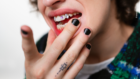 Tatuajes en los dientes