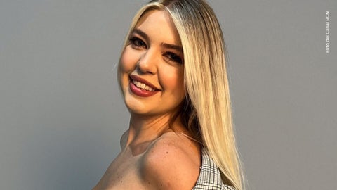 Yana Karpova mostró su nuevo rostro tras los retoques