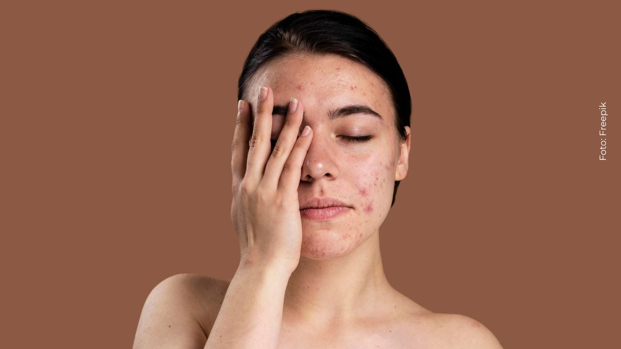 Mujer de 27 años muestra el drástico cambio que tuvo en su rostro durante su embarazo