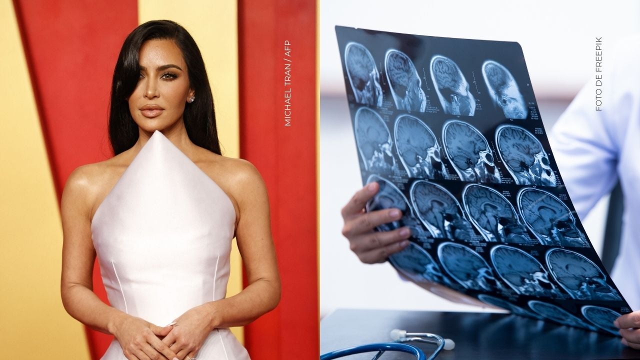 Kim Kardashian reveló que le diagnosticaron un aneurisma cerebral