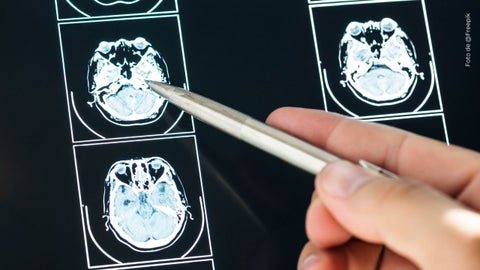 Baby Demoni habría quedado con muerte cerebral si sobrevivía
