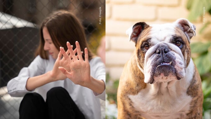 Gaby Ramírez sufrió ataque de un perro bulldog