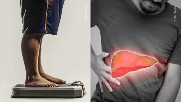 Reconocido influencer reveló entre lágrimas las enfermedades que padece tras años de obesidad