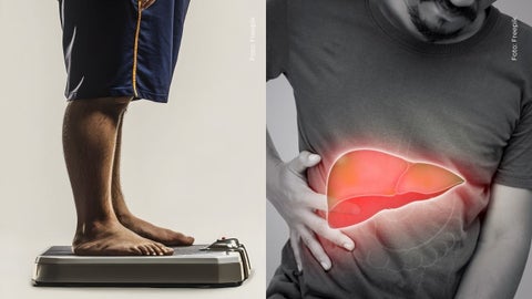 Camilo Triana reveló los problemas de salud que tiene debido a su obesidad