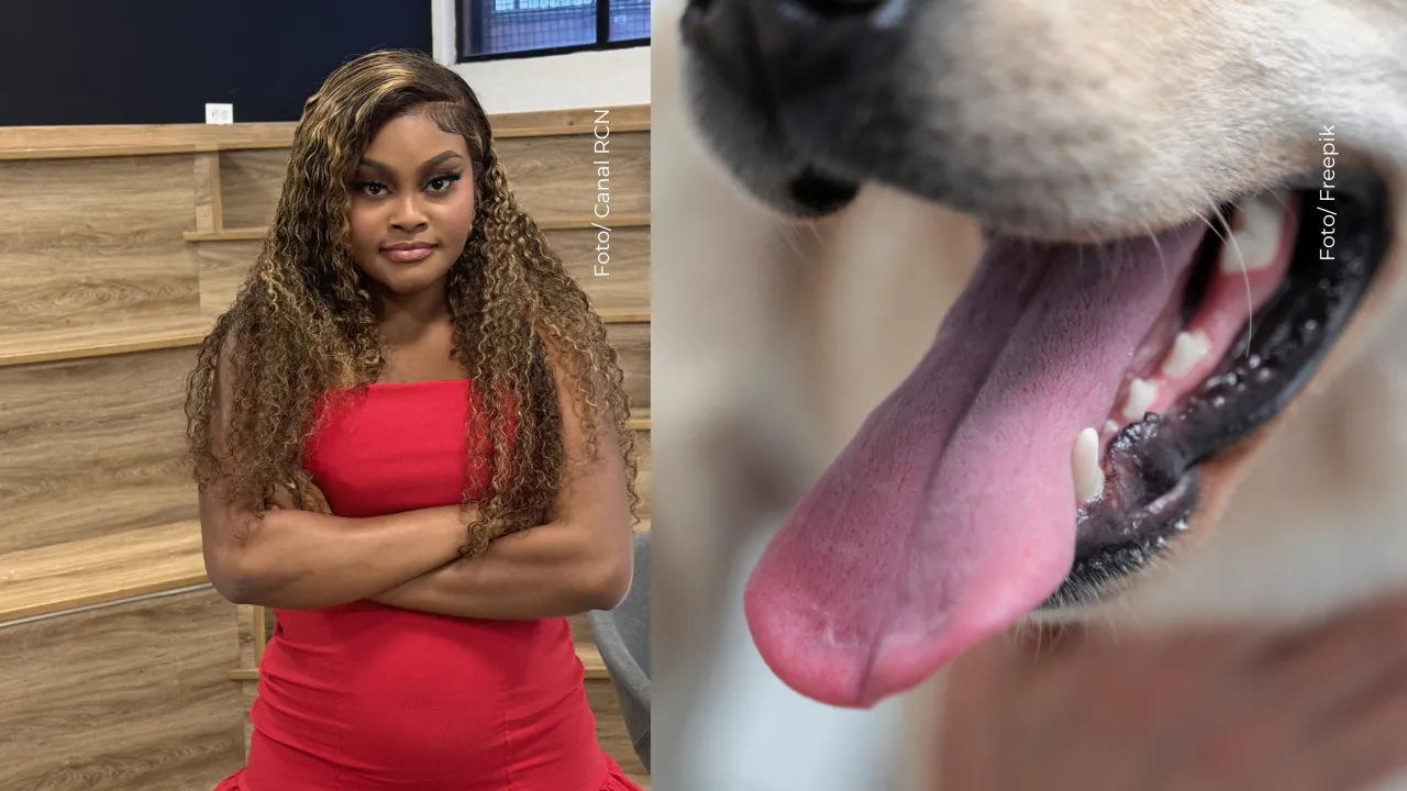 El perro de La Jesuu atacó a Aleyda y terminó en urgencias