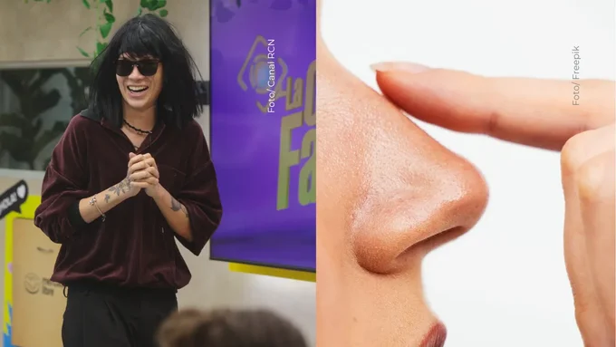 Cami Pulgarín se retoca la nariz: estos serían los posibles efectos