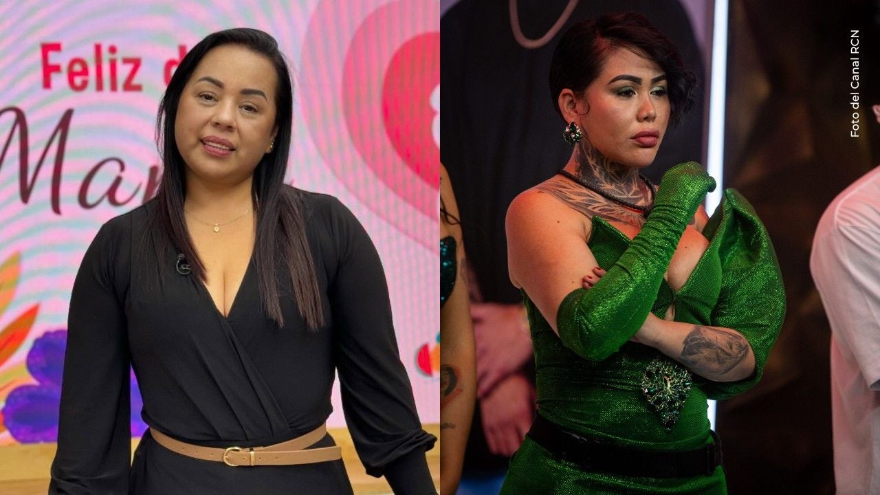 Impactante: madre de Yina Calderón enseña la cicatriz que dejó su accidente en moto