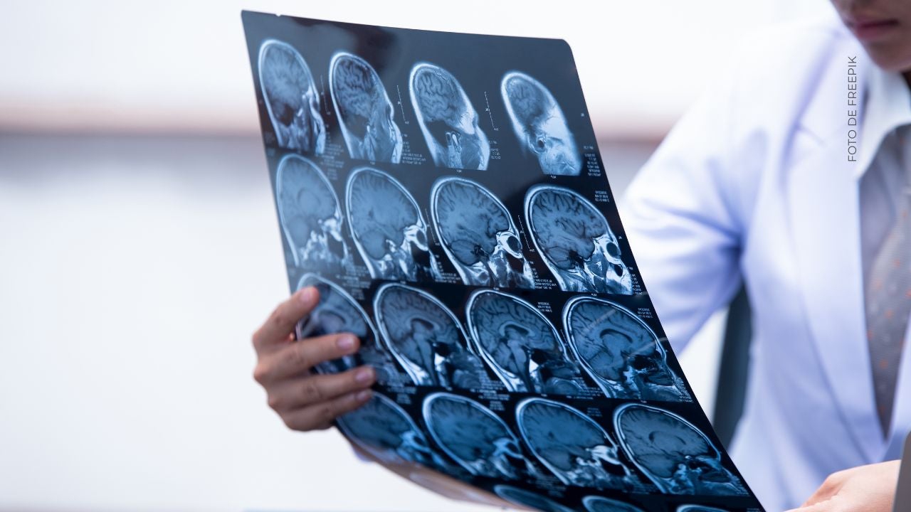 ¿Qué es el TDAH y por qué se diagnostica?