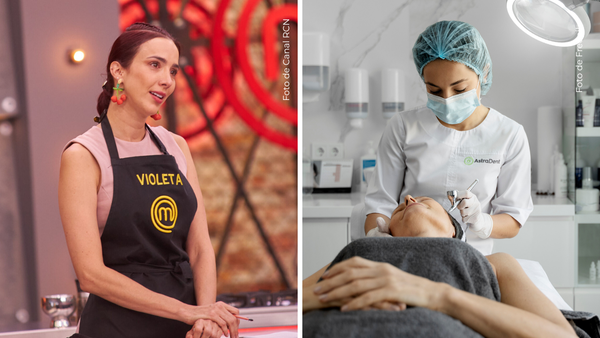 Violeta Bergonzi impactó al mostrar que se aplicó botox en el rostro: así quedó