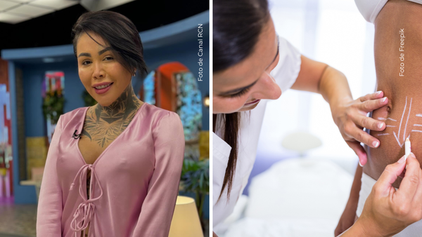 Yina Calderón habló sin tapujos sobre su próxima operación, ¿en qué parte será?