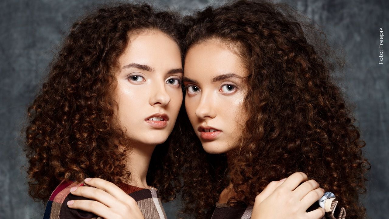 Imagen de gemelas siamesas