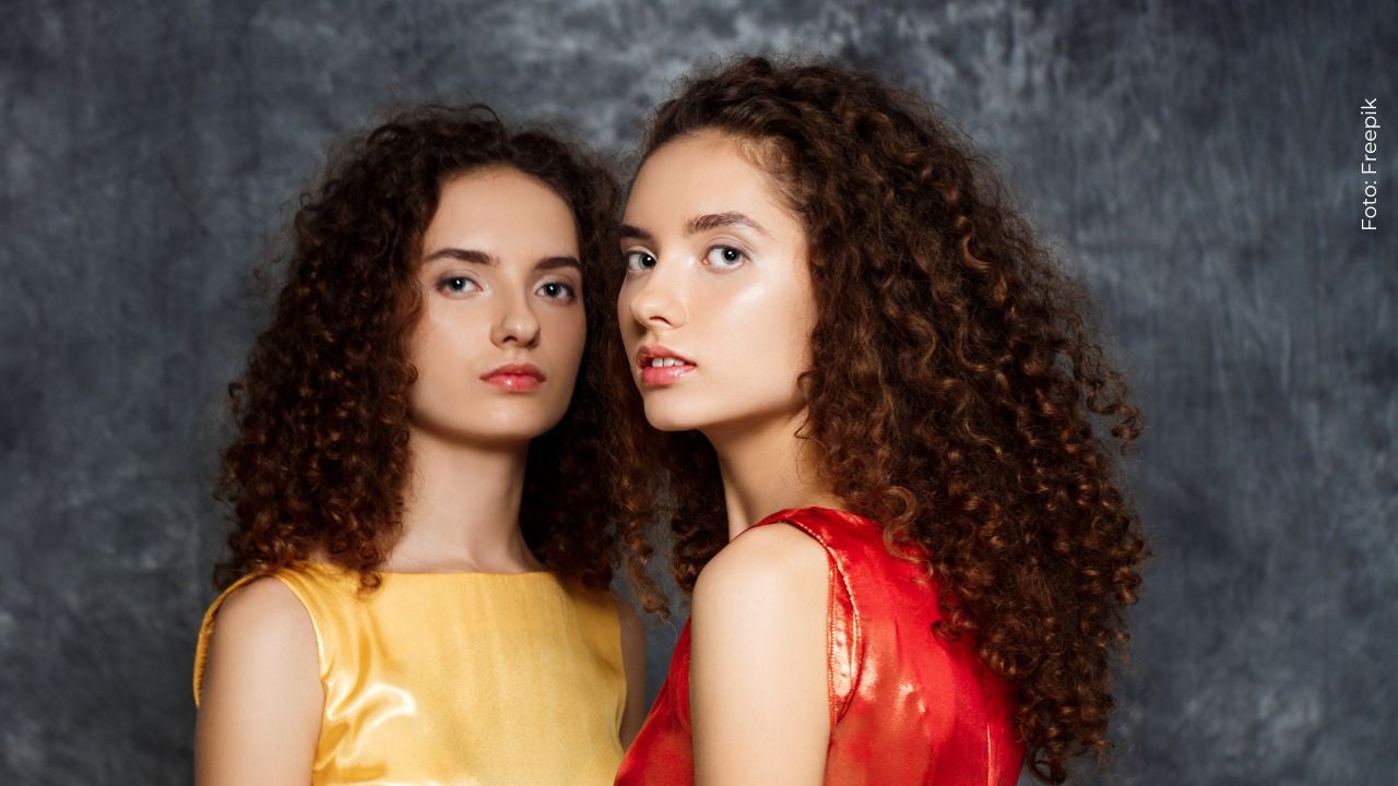 Imagen de gemelas siamesas