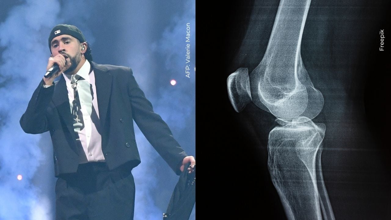 Bad Bunny sufrió lesión en medio de su concierto en Medellín