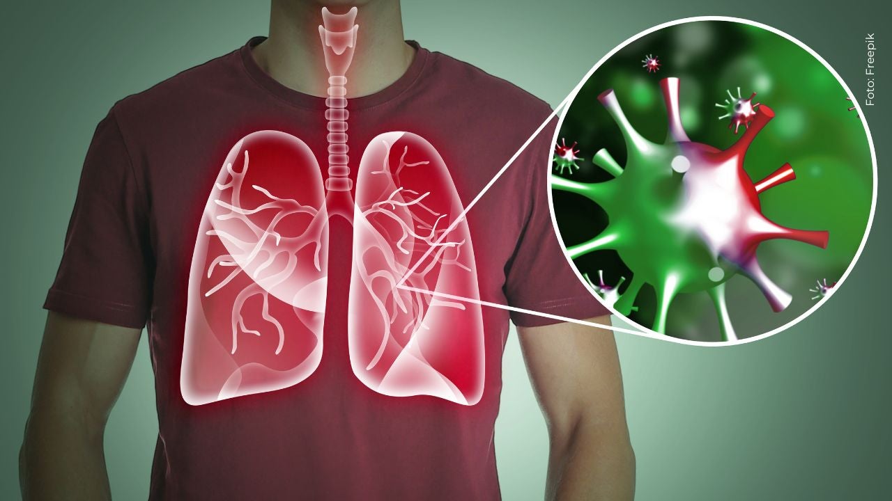 ¿Qué es una infección respiratoria? Las enfermedades de Taliana Vargas y Aida Victoria Merlano