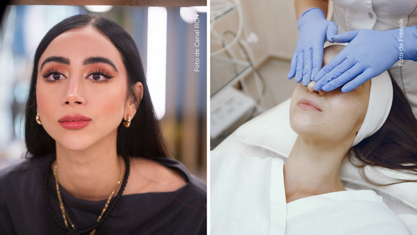 Así lucía Beba antes de realizarse procedimiento estético en su rostro, ¿qué se hizo?