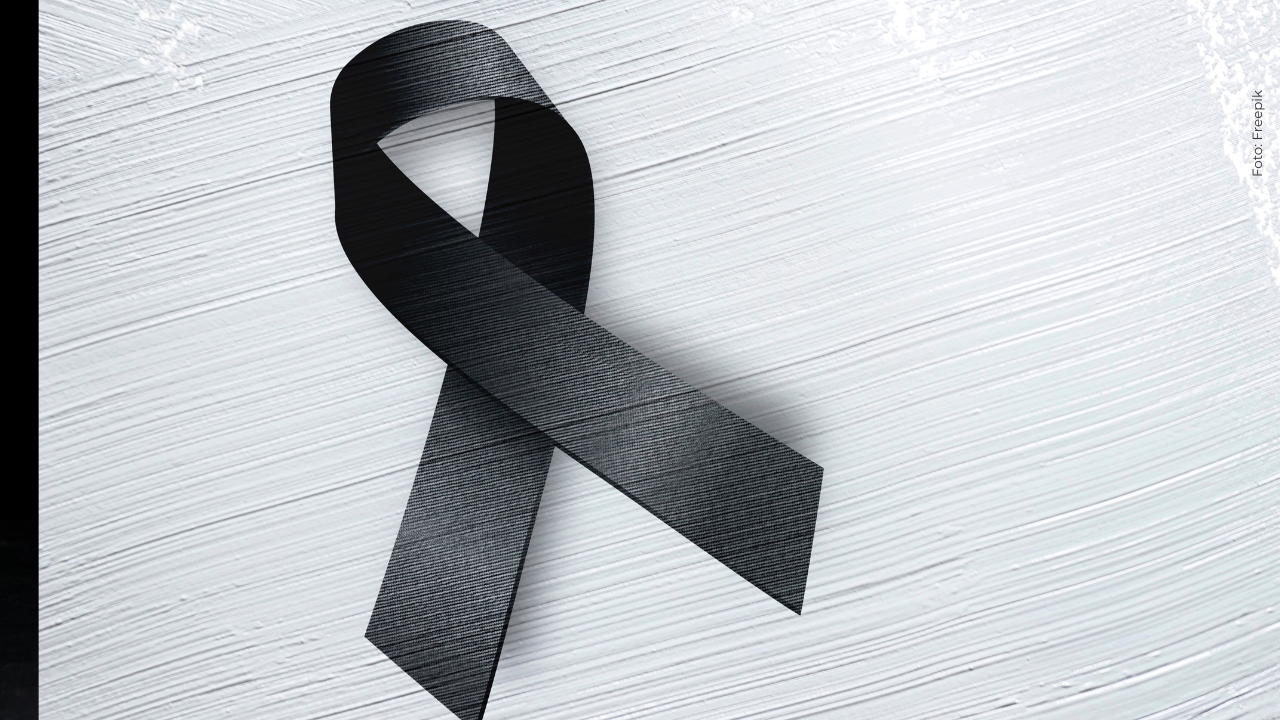 Falleció el influencer que se hizo varas cirugías por parecerse a Kim Kardashian: así se confirmó