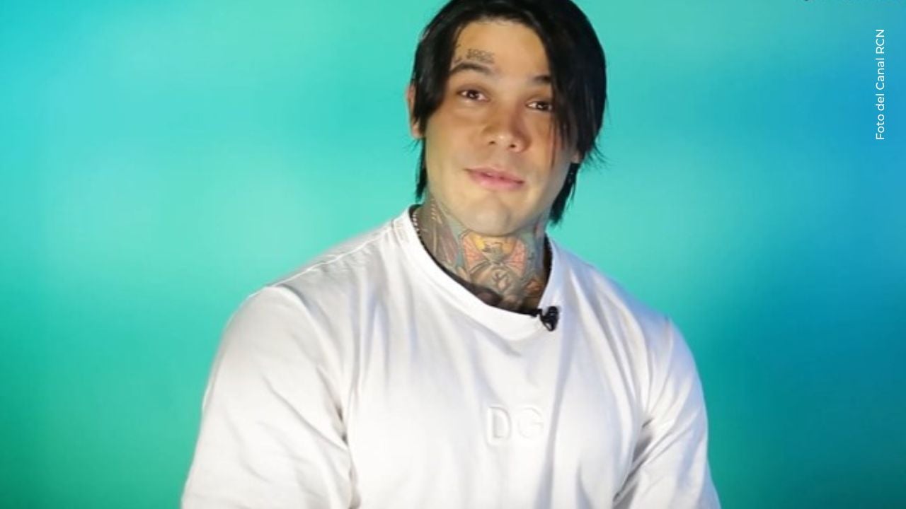 Yeferson Cossio revela que tiene alopecia areata: qué significa este diagnóstico