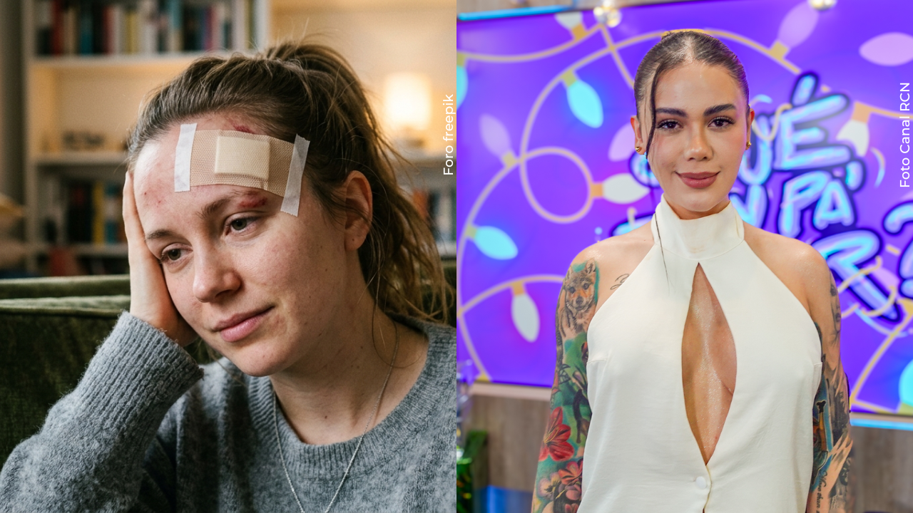 Cintia Cossio genera preocupación tras mostrar fuerte herida en su rostro: esto se sabe