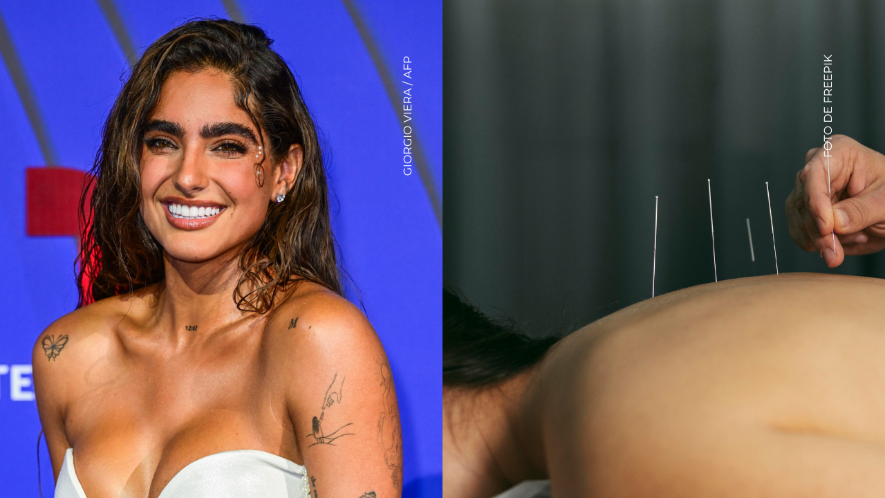 ¿Qué beneficios tiene la acupuntura?