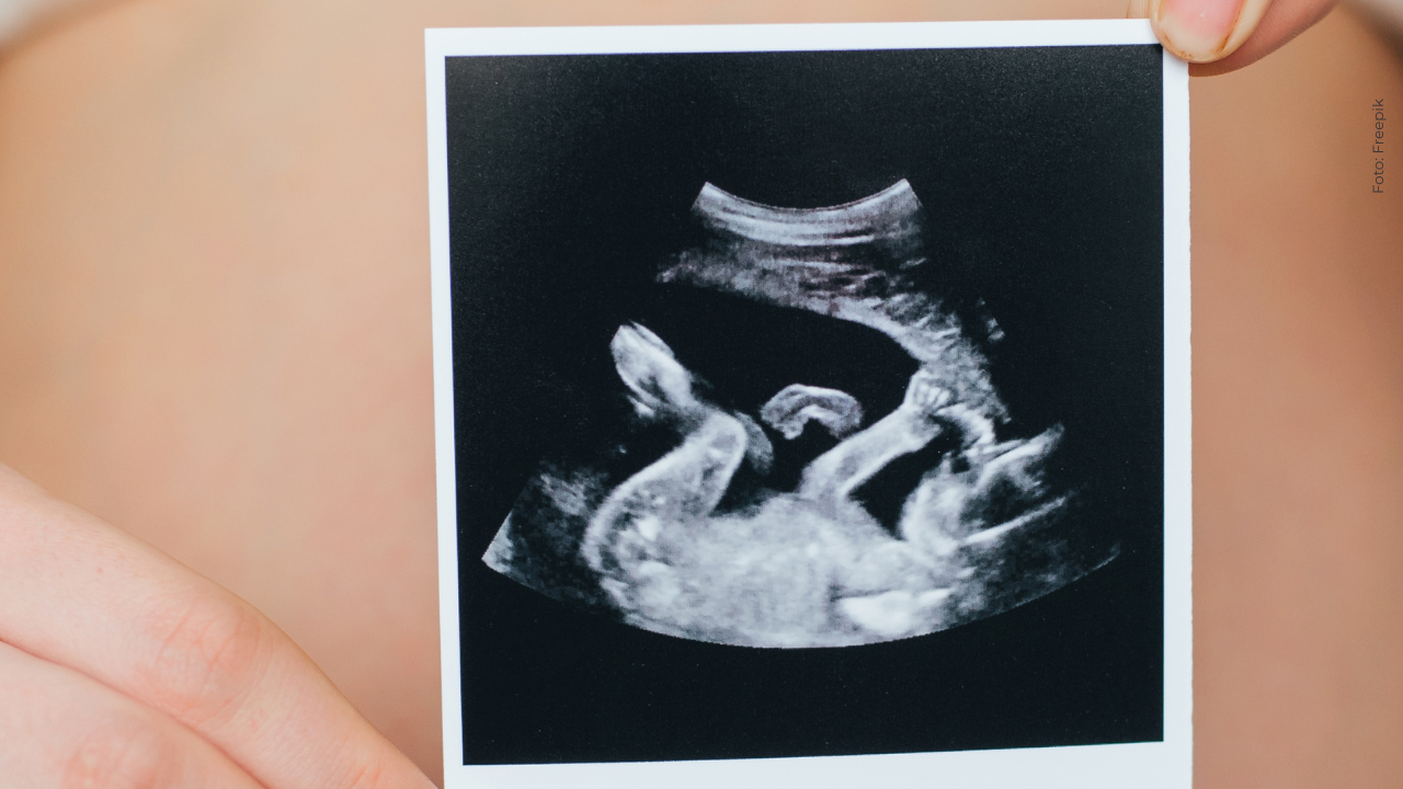 Reconocida actriz que ha participado en producciones del Canal RCN será madre: esta foto lo confirma