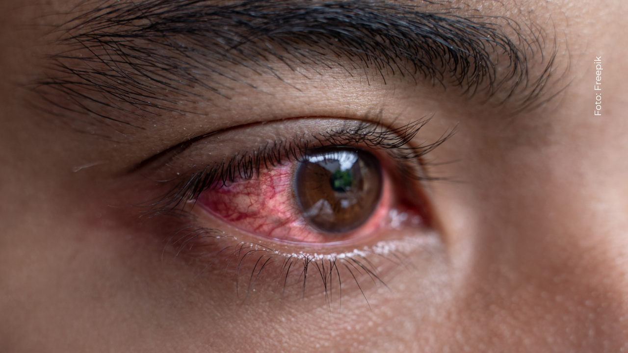 Yeferson Cossio genera preocupación por su salud