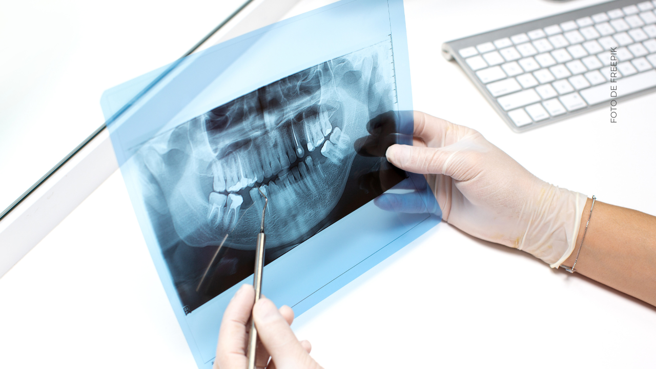 ¿Qué es la endodoncia, procedimiento que se realizó Sheila Gándara?