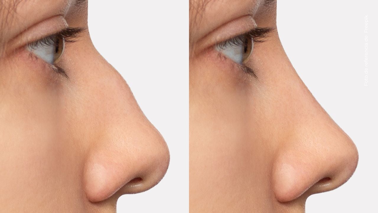 El nuevo rostro de Lily Díaz genera reacciones: reveló el resultado final