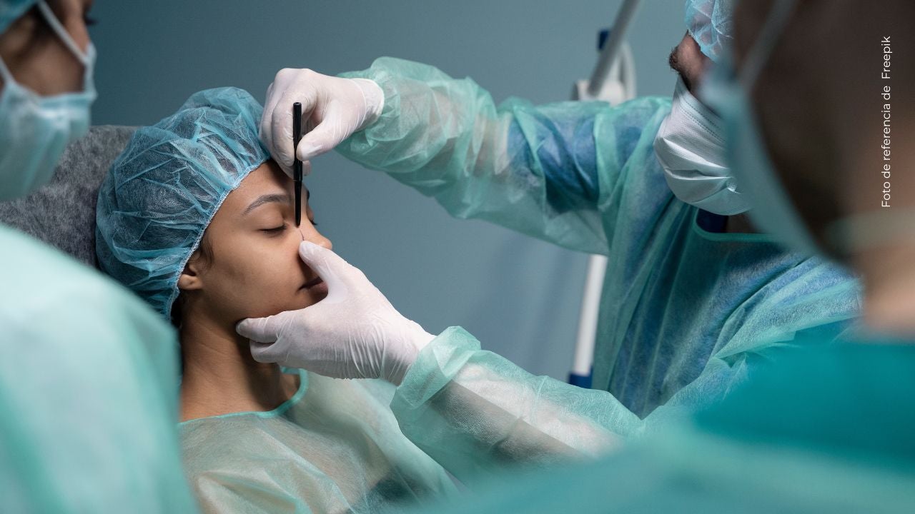 Así luce ahora Lily Díaz tras su retoque facial: sorprendió con el cambio