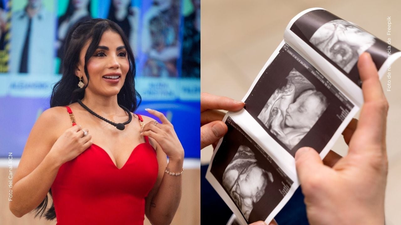 Karina García sorprendió al mostrar la ecografía 3D de su bebé: así se ve su rostro