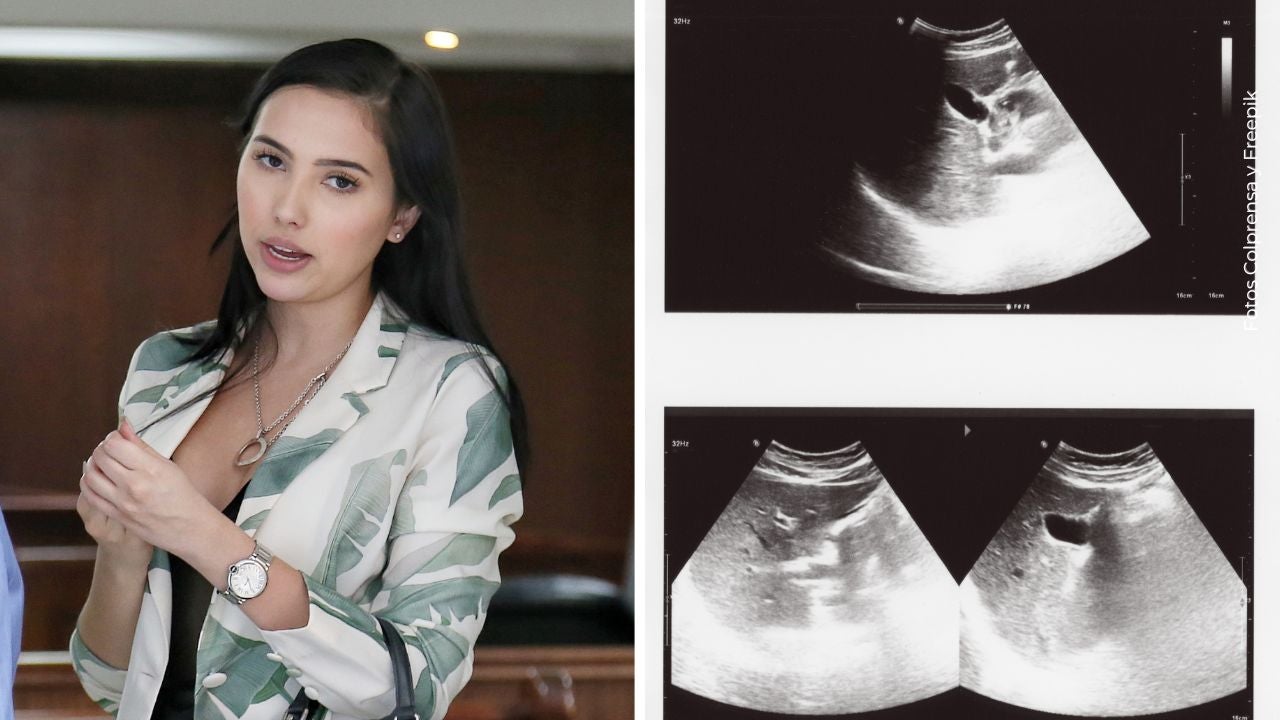 Aida Victoria Merlano reveló si está embarazada