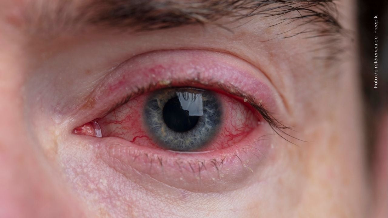 ¿Qué le pasó a Adamari López? La presentadora mostró cómo luce uno de sus ojos
