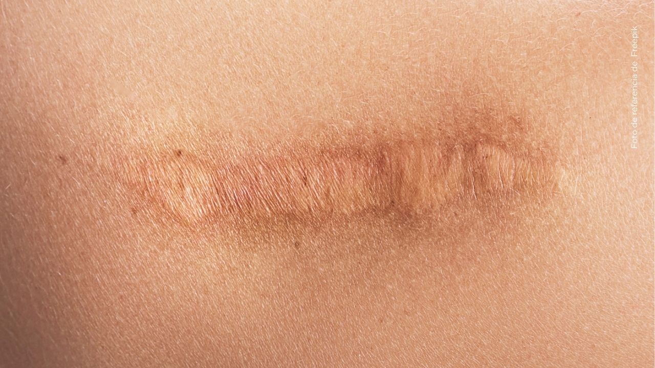 ¿Por qué Luisa Castro tiene cicatrices en su rostro? Ella reveló la razón