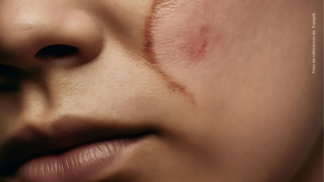 Luisa Castro contó la historia detrás de las cicatrices que tiene en su rostro
